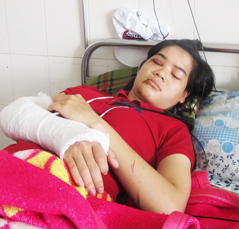 Em Lan bị gãy tay, đa chấn thương, hiện đang điều trị tại BV đa khoa tỉnh Phú Yên.