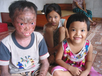 Người đàn bà lúc nào cũng sợ mình chết - 3 Đại gia đình chị Thủy vẫn trông chờ vào những đồng thu nhập ít ỏi từ nghề thủ công dát vàng mã