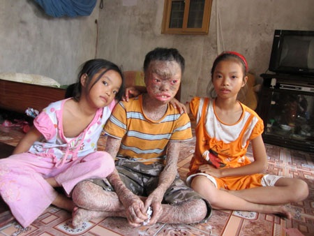 Người đàn bà lúc nào cũng sợ mình chết - 4 Giờ 3 anh em đã lớn hơn trước, nhưng bệnh thì vẫn đeo đẳng suốt chừng ấy thời gian