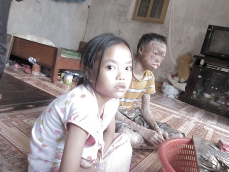 Người đàn bà lúc nào cũng sợ mình chết - 5 Điều làm chị Thủy đau đáu trong lòng là nhỡ chị có mệnh hệ gì thì các con sẽ sống ra sao