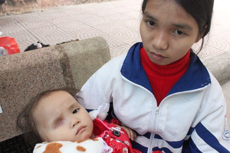 Bé Thảo đang bị sốt, chỉ thi thoảng mở mắt nhìn để cầu cứu đến mẹ