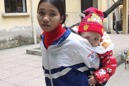 Bị ung thư võng mạc mắt, mắt phải của bé Phương Thảo đã phải múc bỏ để tránh di căn