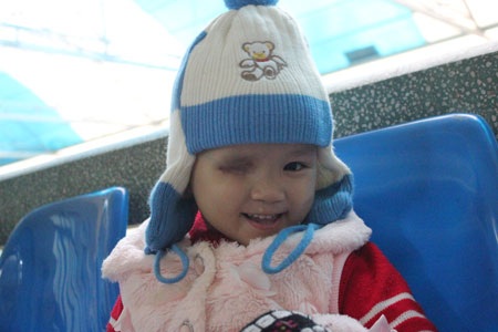 Hơn 76 triệu đồng đến với cô bé một mắt - 1 Nụ cười của bé Phương Thảo tại bệnh viện trông vừa đáng yêu vừa thật đáng thương