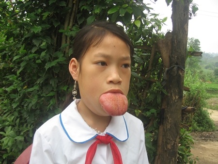 Hạnh phúc những người trở về từ… cõi chết - 9 Hạnh phúc những người trở về từ… cõi chết