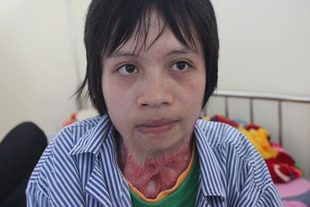 Xót thương cô gái chỉ biết… nhìn thẳng