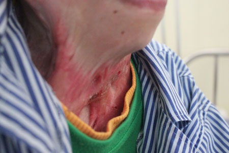 Xót thương cô gái chỉ biết… nhìn thẳng