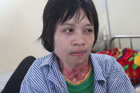 Xót thương cô gái chỉ biết… nhìn thẳng