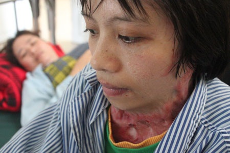 Xót thương cô gái chỉ biết… nhìn thẳng