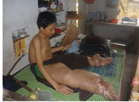 Người đàn ông không đứng nổi trên đôi chân của mình