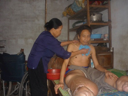 Người đàn ông 44 tuổi nay chỉ biết trông cậy vào mẹ già, từ ăn uống đến vệ sinh tắm rửa