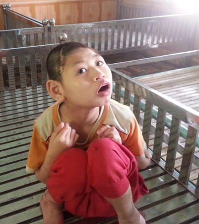 Một em bé giương đôi mắt ngây dại lên nhìn