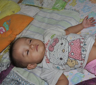 Bé Ánh đang được điều trị tại Bệnh viện Nhi Trung ương.