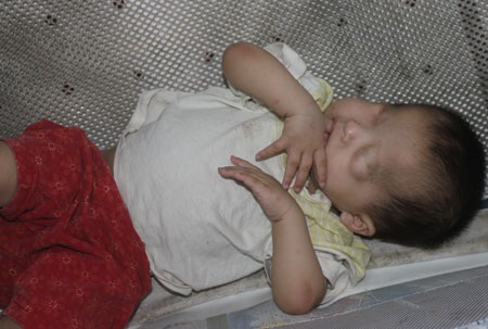 Cuộc đời của bé Hồng Mai càng bi kịch hơn khi bố mẹ em đan tâm bỏ rơi em ngay lúc lọt lòng