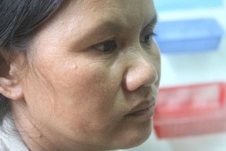 Đáng thương bệnh nhân gặp cảnh nếu bác sĩ “buông tay là chết” - 4 Sự bất lực pha lẫn buồn bã của chị Lê Thị Sáu trước tình cảnh nguy nan của người chồng