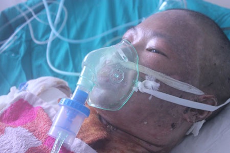 Bỏng gas hơn 50% cơ thể, tính mạng người mẹ trẻ nguy kịch - 4 Nỗi đau về thể xác có thể không là gì cả so với nỗi đau tinh thần khi chẳng may người mẹ mất đi