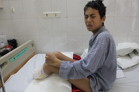 Bỏng điện cao thế, cậu bé 15 tuổi mất một cánh tay và hai cẳng chân - 1 Bỏng điện cao thế, cậu bé 15 tuổi mất một cánh tay và hai cẳng chân