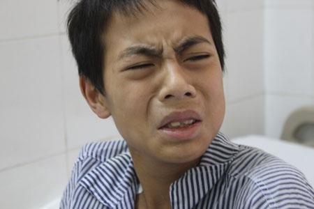 Bỏng điện cao thế, cậu bé 15 tuổi mất một cánh tay và hai cẳng chân - 4 Dù đau đớn lắm nhưng Vượng vẫn cố kìm nén để bố mẹ bớt lo lắng cho bản thân mình