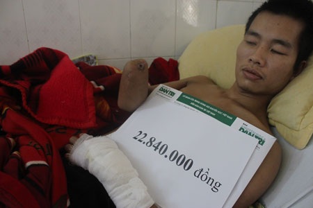 Hơn 22 triệu đồng đến với bệnh nhân bỏng điện Lê Thanh Tùng - 3 Anh Tùng nhận 22.840.000 đồng do bạn đọc ủng hộ qua Quỹ Nhân ái