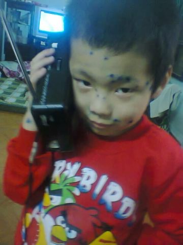 Bé Ngọc Diệp đã mất do biến chứng ung thư máu - 4 Nay bé đã từ biệt cõi nhân gian với bao đớn đau bệnh tật