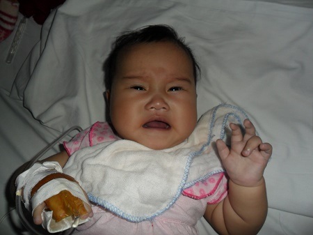 Bị tim bẩm sinh thể phức tạp, bé 6 tháng tuổi nguy kịch