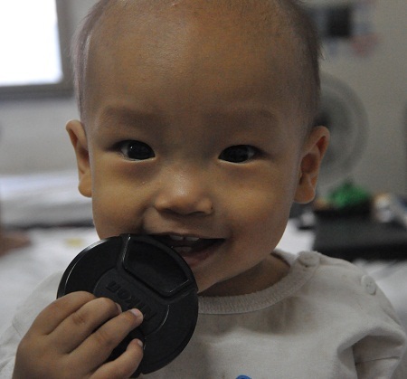 Nụ cười rất đáng yêu mà cũng rất đáng thương của bé Hà Thanh Bình