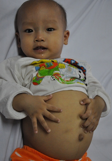 Bé 22 tháng tuổi vẫn đang chờ một phép màu