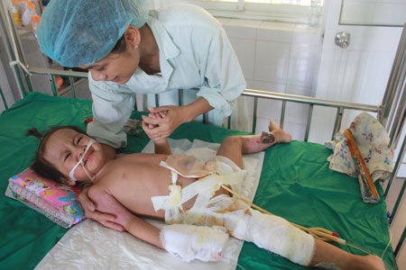 Bé 2 tuổi rưỡi dập nát nửa người vì còi hơi xe tải - 1 Nửa dưới cơ thể của bé Vàng Minh Châu dập nát do bánh xe tải cán qua