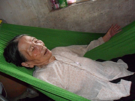 Nỗi đau đớn của người đàn ông mắc bệnh vảy nến hơn 20 năm - 4 Mẹ của anh Mừng bị tai biến mạch máu não 2 năm nay chỉ có thể nằm một chỗ