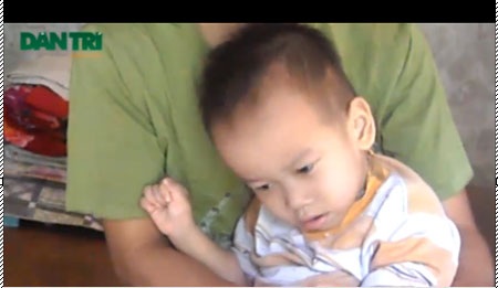 Sự sống mong manh của hai anh em cùng mắc bệnh bại não - 2 Sự sống mong manh của hai anh em cùng mắc bệnh bại não