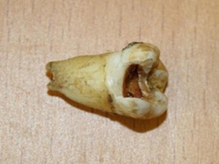 10 thương vụ đắt giá nhất tháng 11 - 2 10 thương vụ đắt giá nhất tháng 11 - 2