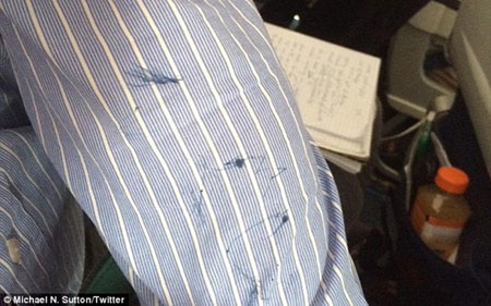 Cánh tay bị đâm của ông Lenny. (Ảnh