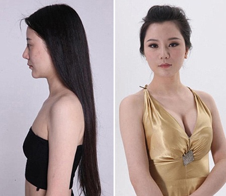 Những ca phẫu thuật thẩm mỹ "gây choáng váng" của phụ nữ Trung Quốc - 7 Mi Vân