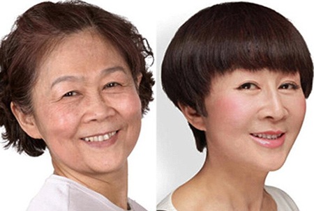 Những ca phẫu thuật thẩm mỹ "gây choáng váng" của phụ nữ Trung Quốc - 10 Mi Vân
