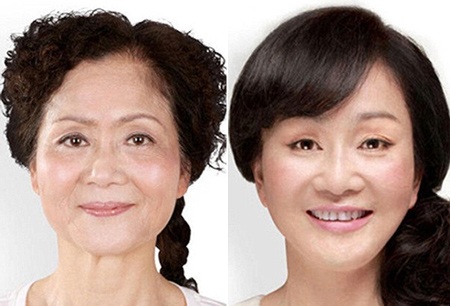 Những ca phẫu thuật thẩm mỹ "gây choáng váng" của phụ nữ Trung Quốc - 11 Mi Vân