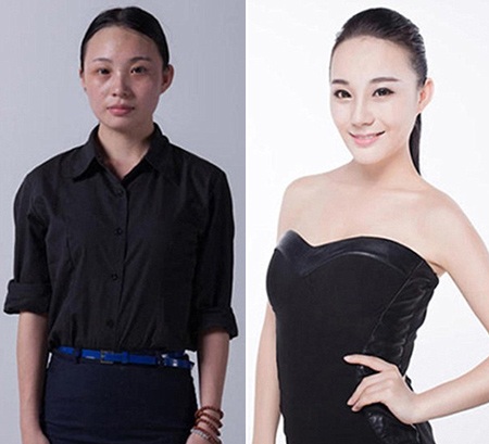 Những ca phẫu thuật thẩm mỹ "gây choáng váng" của phụ nữ Trung Quốc - 2 Xu hướng phẫu thuật thẩm mỹ làm đẹp của phụ nữ Trung Quốc