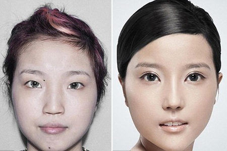 Những ca phẫu thuật thẩm mỹ "gây choáng váng" của phụ nữ Trung Quốc - 5 Xu hướng phẫu thuật thẩm mỹ làm đẹp của phụ nữ Trung Quốc