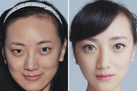 Những ca phẫu thuật thẩm mỹ "gây choáng váng" của phụ nữ Trung Quốc - 12 Mi Vân