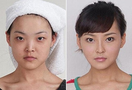 Những ca phẫu thuật thẩm mỹ "gây choáng váng" của phụ nữ Trung Quốc - 15 Mi Vân