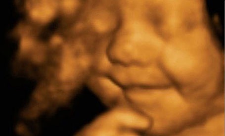 “Nụ cười chiến thắng” của em bé nằm trong bụng mẹ - 1 Leo David Hargreaves mỉm cười khi còn trong bụng mẹ.