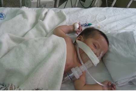 Bé không có hậu môn và tim bẩm sinh vẫn trong tình trạng nguy hiểm - 1