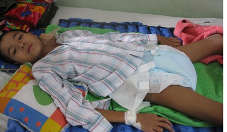 Bố ơi, bao giờ con sẽ ngồi dậy được ? - 1