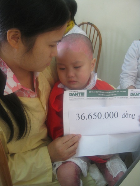 Hơn 36 triệu đồng đến với cháu bé 4 tuổi bị bỏng nặng - 1