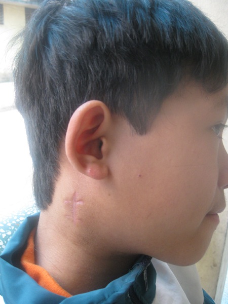 Mẹ đớn đau vì hai con bị ung thư