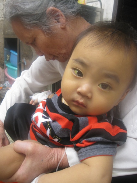 Bé thơ 2 tuổi mắc bệnh tan máu hiếm gặp