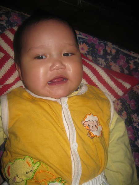 Chạnh lòng trước trái tim lỗi nhịp của bé 1 tuổi - 1 Chạnh lòng trước trái tim lỗi nhịp của bé 1 tuổi