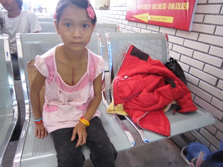 15 tuổi nhưng chỉ nặng 20 kg, trông Hương không khác gì học sinh cấp 1