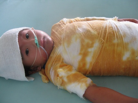 Ở bệnh viện, cô bé Huyền ngoan ngoãn nằm yên để mong khỏi bệnh về nhà chơi búp bê