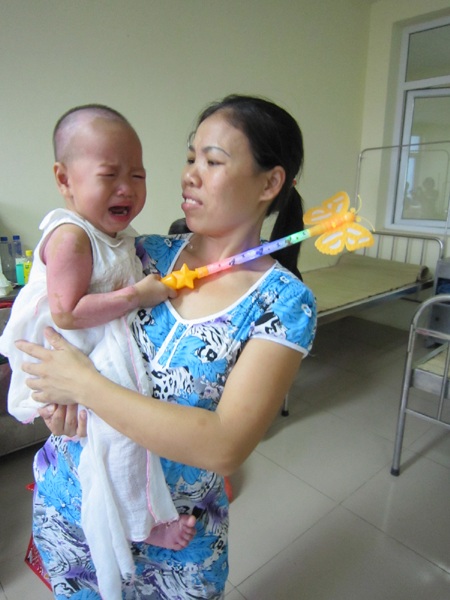 Hơn 600 triệu đồng đến với các em bé bị bỏng nặng - 4 Tình trạng của Quyên đã tương đối ổn định, hiện tại em đã được chuyển sang khoa Phục hồi chức năng