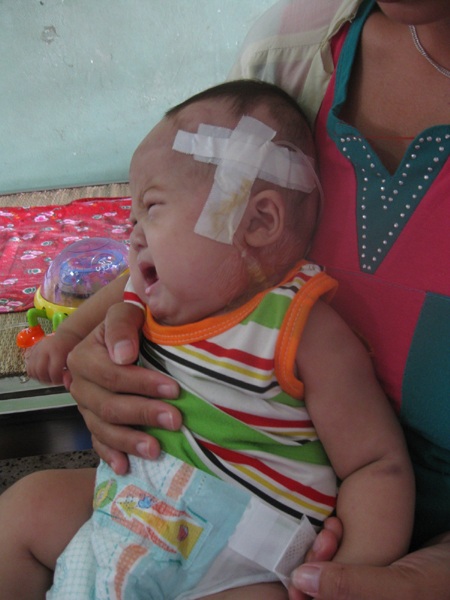 Thương bé San San 7 tháng tuổi bị nhiễm trùng máu nặng - 1 Thương bé San San 7 tháng tuổi bị nhiễm trùng máu nặng