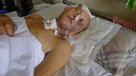 Người đàn ông nằm viện với hồ sơ bệnh án "vô danh" - 1 Bị chấn thương sọ não nghiêm trọng, người đàn ông này đang được điều trị tại bệnh viện Thanh Nhàn